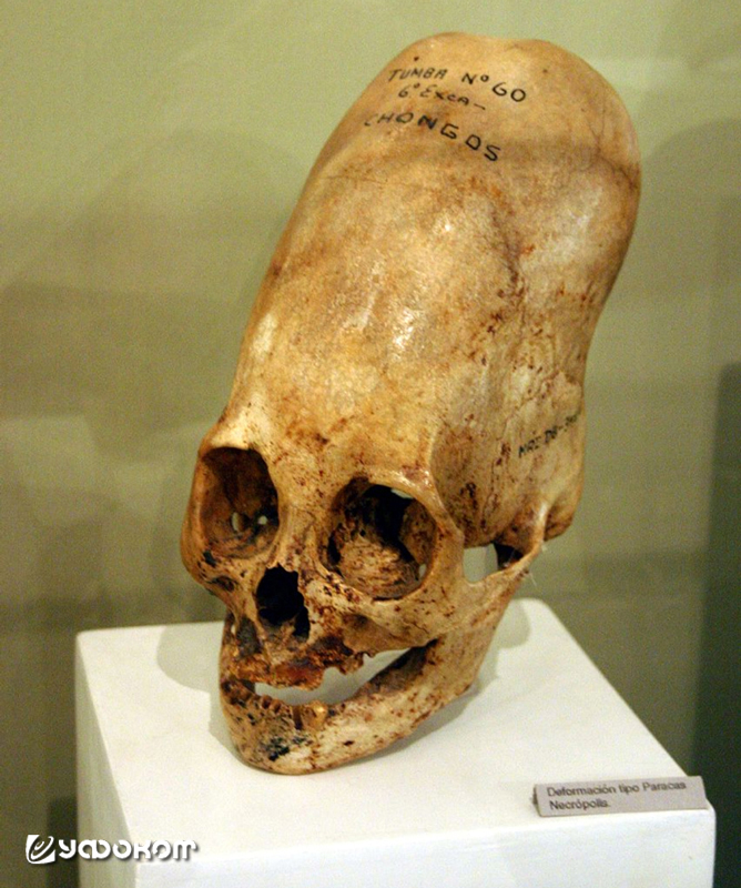 08-cherep-konnoly.jpg